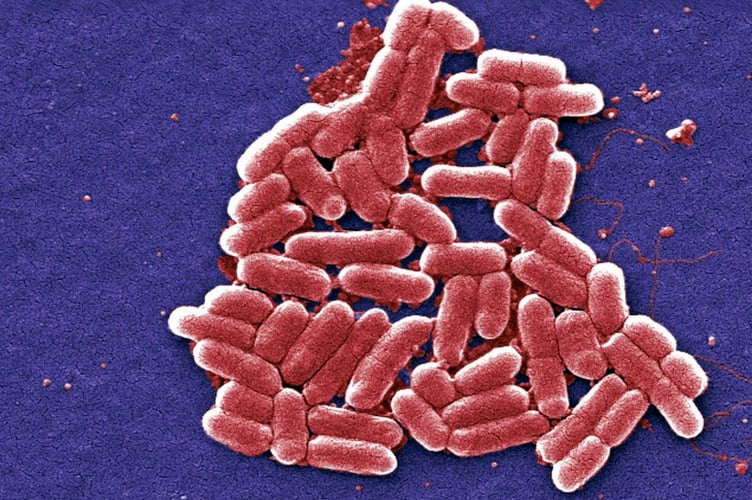 2006
National Escherichia, Shigella, Vibrio Reference Unit at CDC

Under a magnification of 6836x, this colorized scanning electron micrograph (SEM) depicted a number of Gram-negative <i>Escherichia coli</i> bacteria of the strain O157:H7, which is one of hundreds of strains of this bacterium. Although most strains are harmless, and live in the intestines of healthy humans and animals, this strain produces a powerful toxin, which can cause severe illness.<p><i>E. coli</i> O157:H7 was first recognized as a cause of illness in 1982 during an outbreak of severe bloody diarrhea; the outbreak was traced to contaminated hamburgers. Since then, most infections have come from eating undercooked ground beef.<p>The combination of letters and numbers in the name of the bacterium refers to the specific markers found on its surface, which distinguishes it from other types of <i>E. coli</i>. See PHIL 8800 for a black and white version of this image.

<i>Escherichia coli</i> O157:H7 is an emerging cause of foodborne illnes