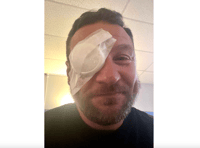 Golfer blinded in one eye by wayward shot